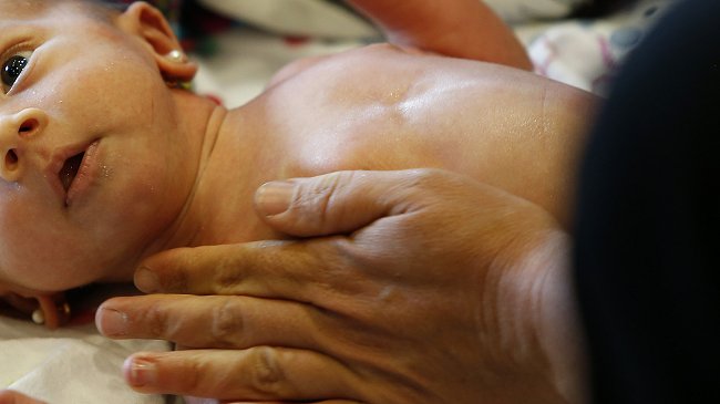 Cómo identificar un contagio con el peligroso coqueluche