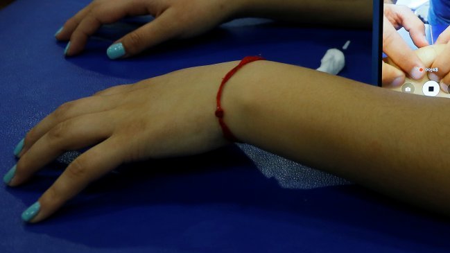 Autoridades descubrieron brote de sarna en colegio del Biobío