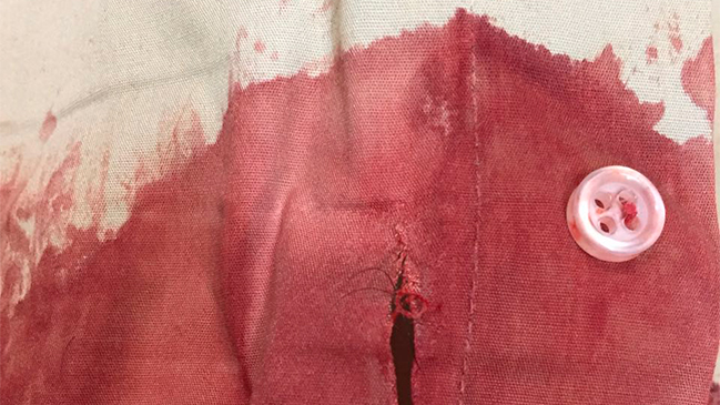 Carabinero fue apuñalado al acudir a llamado por violencia intrafamiliar