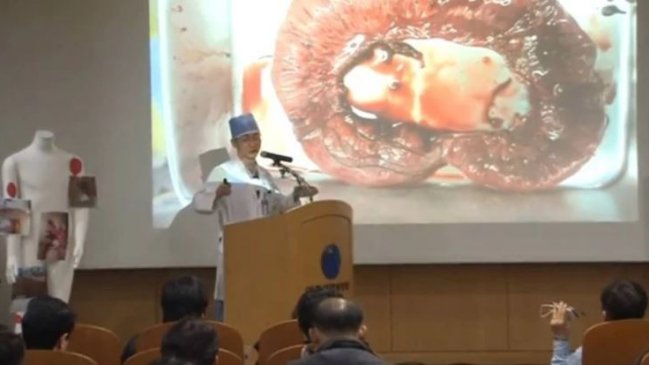 Encuentran lombrices en cuerpo de soldado norcoreano que desertó