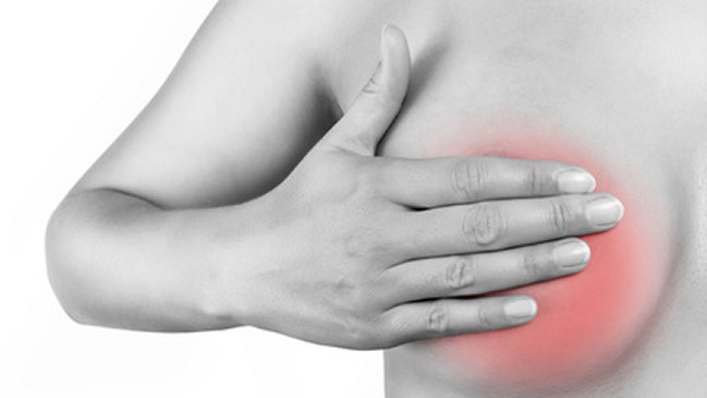 Mujeres con sobrepeso tienen más riesgo de no detectar cáncer de mama