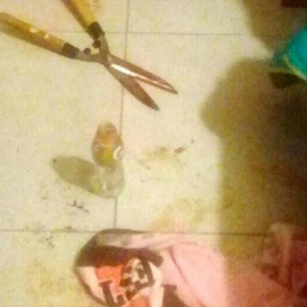 Mujer cortó el pene de hombre con tijera podadora: Asegura que sufrió agresión sexual