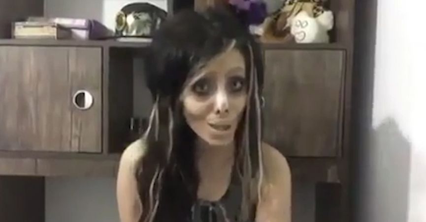 Fan de Angelina Jolie que dijo hacerse 50 cirugías reveló la verdad de su historia