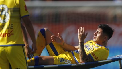  Leyton fue operado para corregir la doble fractura  