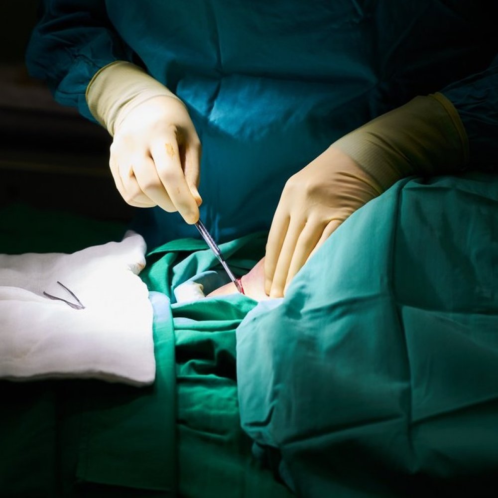 Arrestan a hombre por robarle un riñón a su esposa