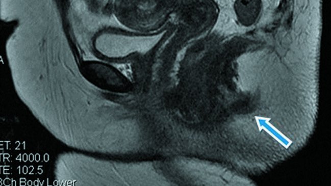 Médicos descubren a mujer con dos anos en Portugal