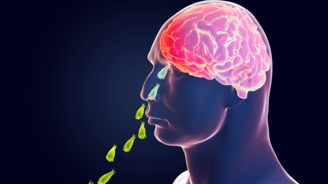 Niño murió por ameba 