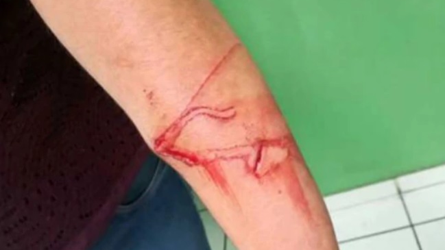 Niño acuchilló a su profesora por no dejarlo ir al baño