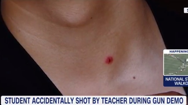 Profesor disparó accidentalmente en clases e hirió a un alumno