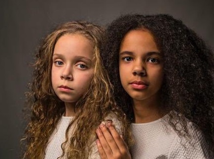 [Fotos] Las gemelas que sorprenden al mundo: Una es blanca y la otra