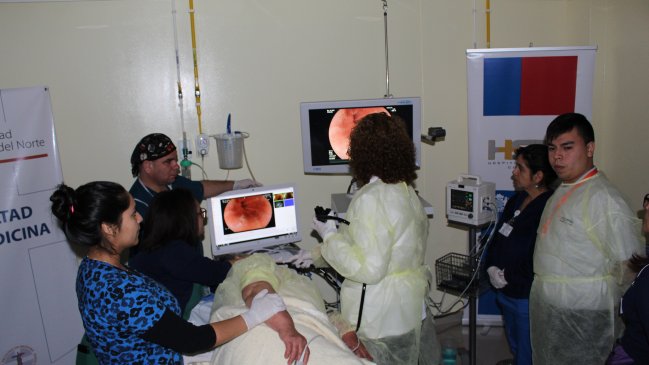 Hospital de Coquimbo recibe equipo clave para la detección precoz del cáncer gástrico