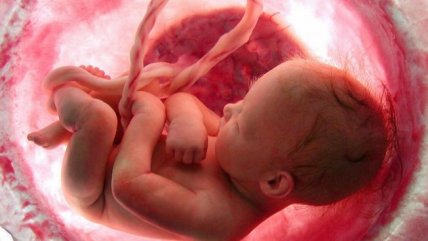   Tus Años Cuentan: Las diferencias entre el parto natural y el quirúrgico 