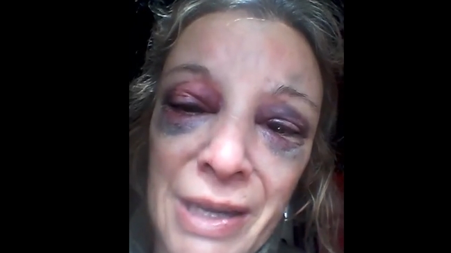 Mujer se negó a tener relaciones y recibió un ladrillazo en la cabeza