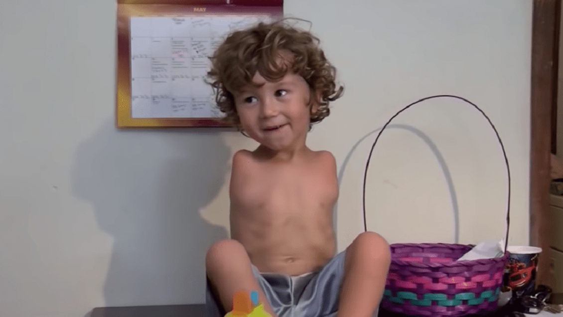 Restaurante se disculpó por echar a un niño sin brazos que comía con los pies