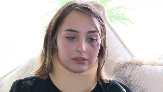 Actriz mexicana enfrentó a su agresor sexual y este la golpeó en el rostro