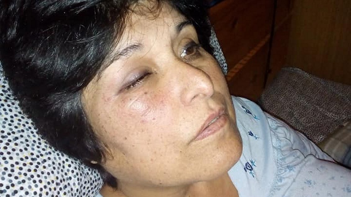 Colegio de Profesores pide cárcel por golpiza a maestra