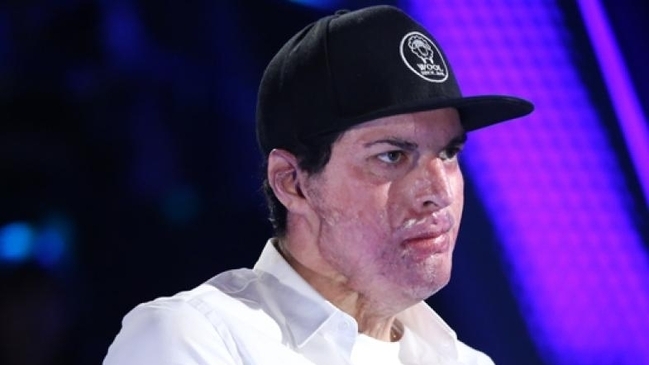 Ignacio Lastra contó detalles de cómo obtuvo el alta médica