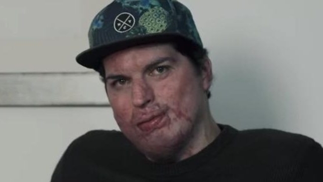 El gran sueño de Ignacio Lastra que lo motivó a seguir viviendo