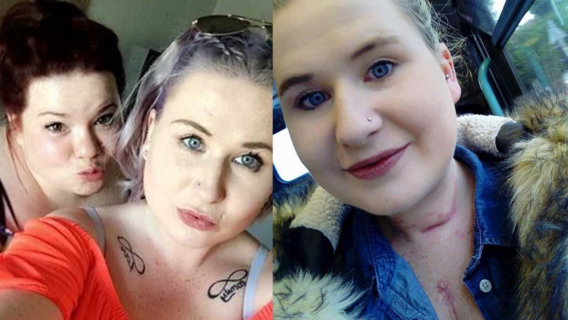 Mujer apuñaló a su amiga 17 veces en medio de juego sexual