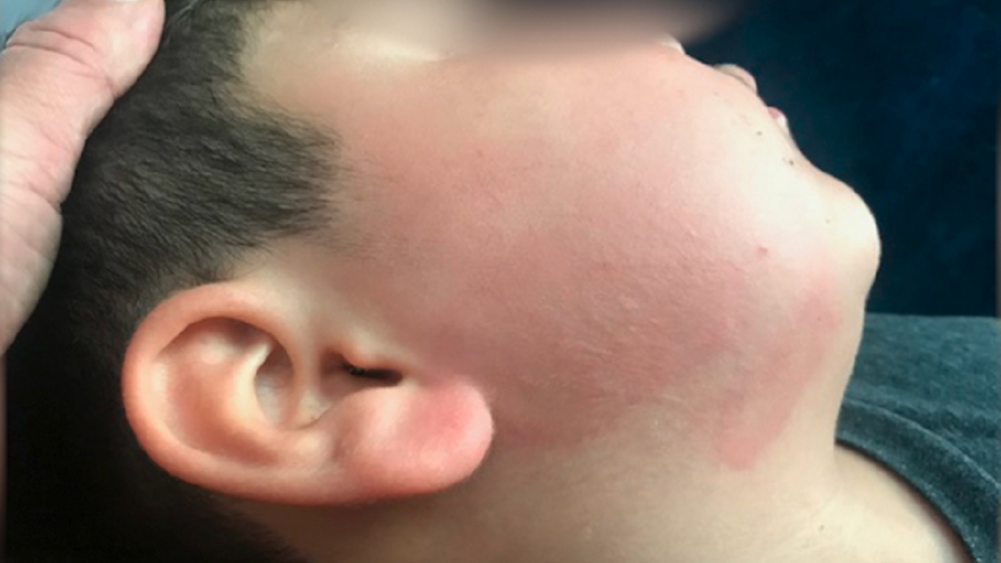 Denuncian maltrato de empleado de colegio a niño con necesidades especiales