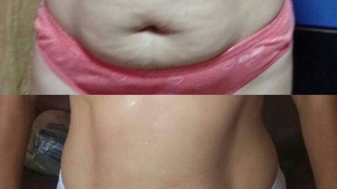 Descubren tratamiento para bajar de peso en Huara