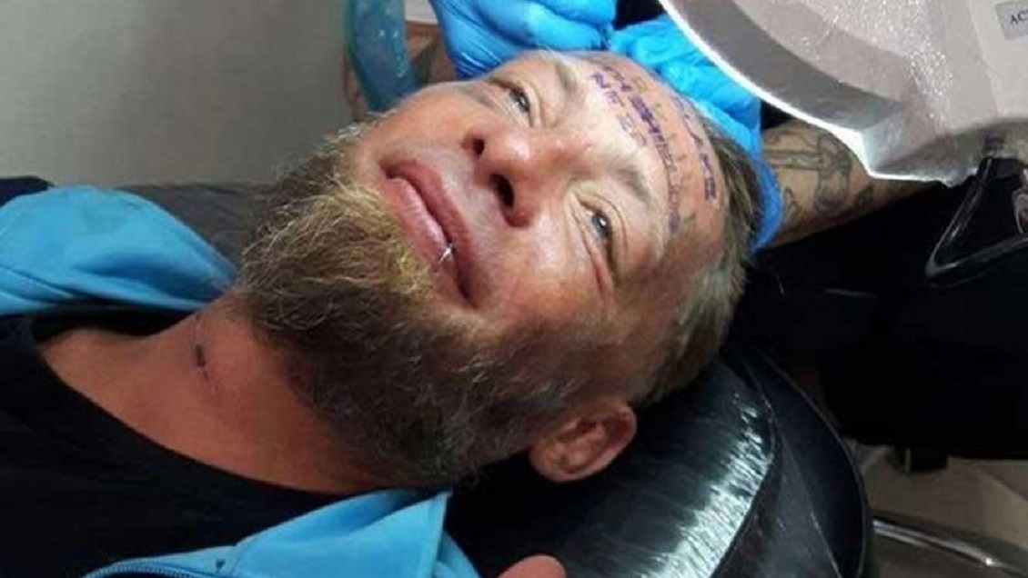 Turistas en despedida de soltero hicieron que un indigente se tatuara en la frente