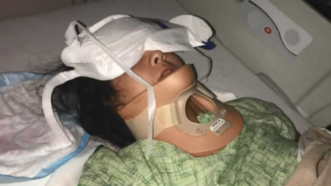 Joven de 18 años terminó en estado crítico tras caerse haciendo el #KikiChallenge