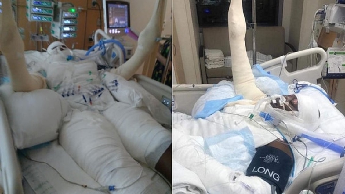 Niña de 12 años quiso hacer un desafío viral y casi murió