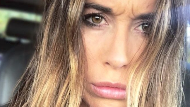 La abultada cuenta que deberá pagar Valentina Roth por su lesión