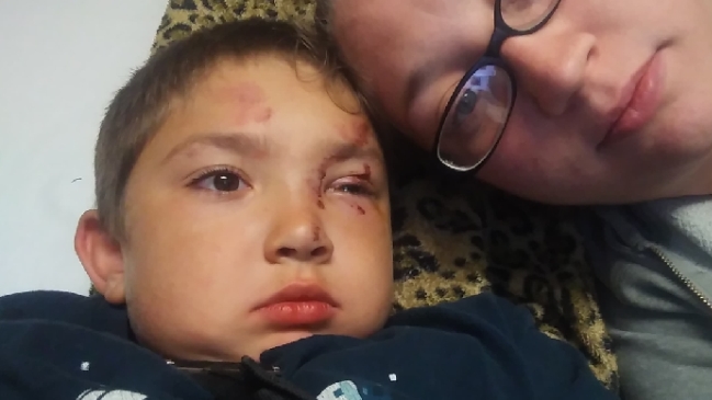 Niño autista terminó hospitalizado luego de defender a su amigo del bullying