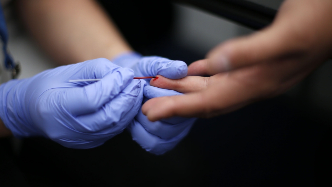 Universidad de Concepción aplicará 4.000 exámenes de VIH a sus estudiantes