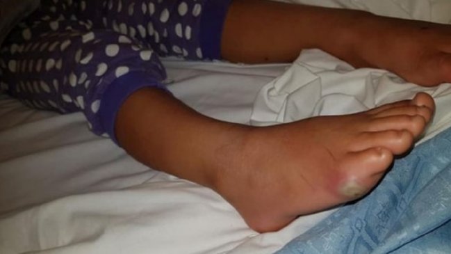 Niña contrajo infección mortal por probarse zapatillas sin calcetines