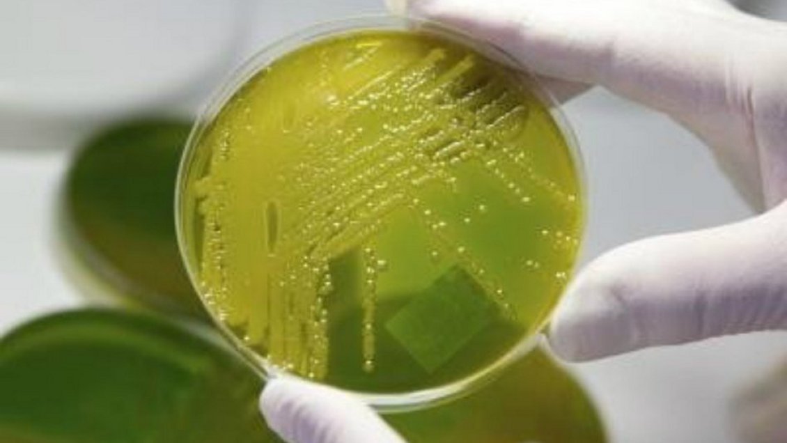 Bacteria en Argentina: Van nueve fallecidos y hay otro caso en estudio