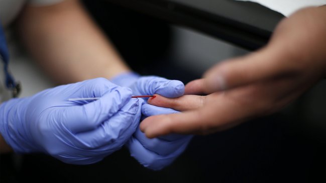 Tarapacá implementará una estrategia masiva de detección de VIH con test rápidos