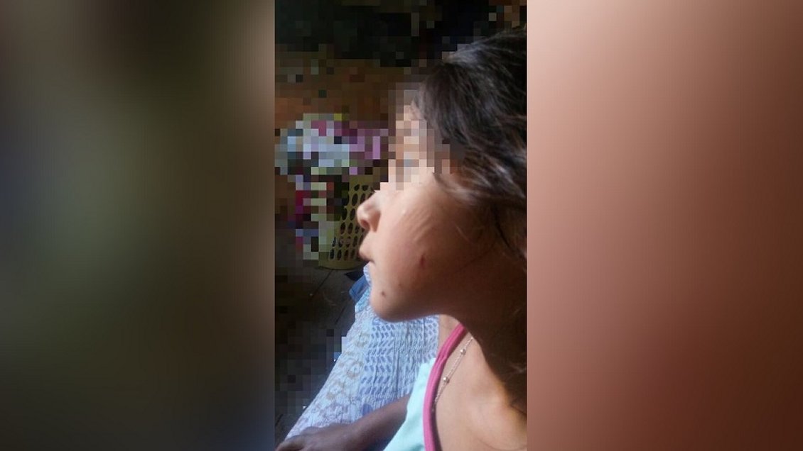 Superintendencia investiga golpiza a niña de seis años en colegio de Coquimbo