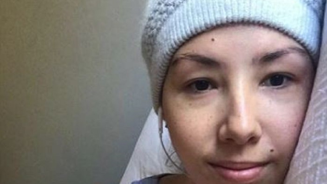 Joven fingió tener cáncer y reunió millones de pesos en donaciones