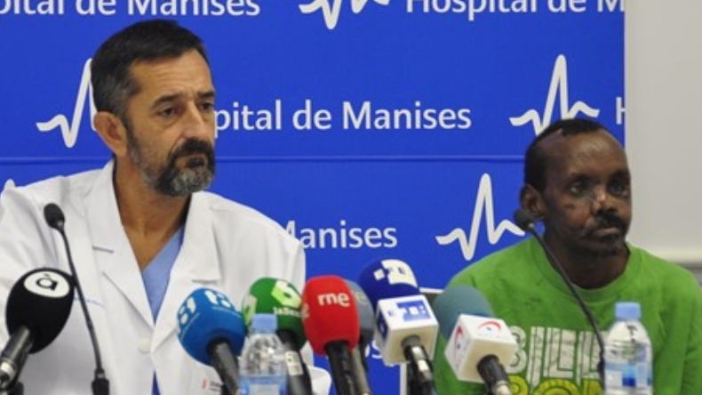 Cirujano español reconstruyó el rostro y la mano de hombre atacado por una hiena