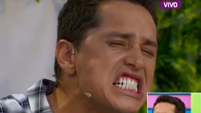 Karol Lucero confesó que se puso bótox en el rostro