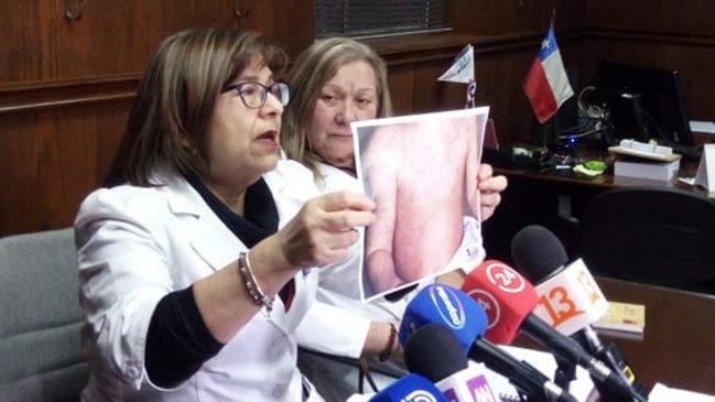 Minsal intenta ubicar a pasajeros que volaron con mujer contagiada de sarampión