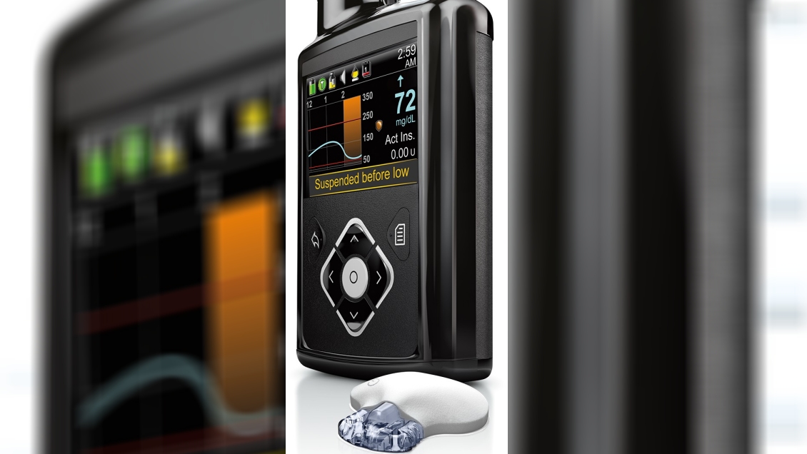 Día de la Diabetes: 651 pacientes están con bomba de insulina gracias a Ley Ricarte Soto