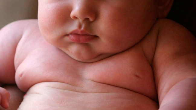 Niños obesos tienen mayor riesgo de muerte o discapacidad