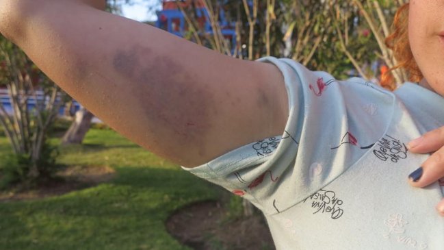 Estudiantes de la Unap acusan abuso de Carabineros en toma