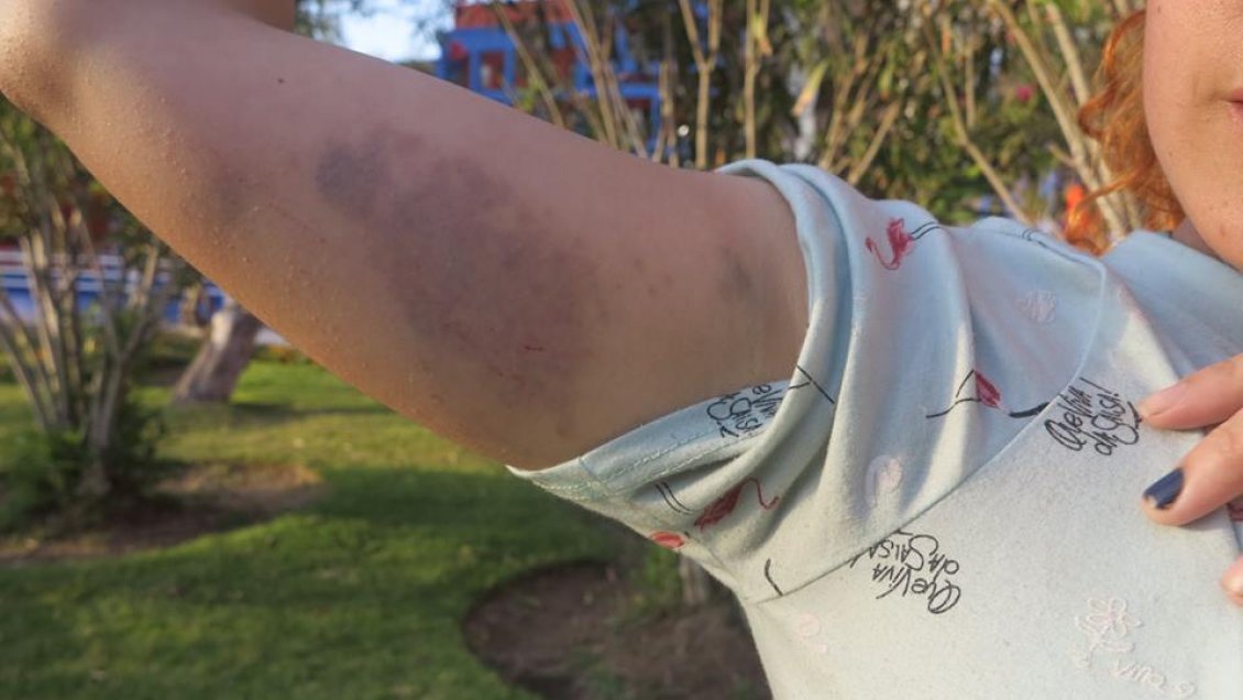 Estudiantes de la Unap acusan abuso de Carabineros en toma