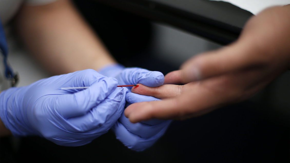 Chile: Entre los 10 países con mayor aumento de VIH