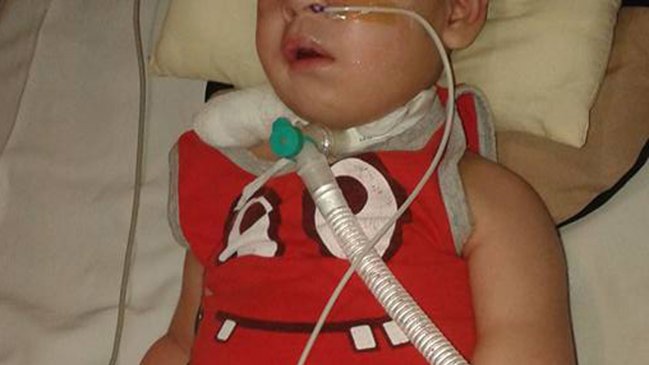 Familia tuvo que recurrir a Bomberos por corte de luz para asistir a bebé electrodependiente