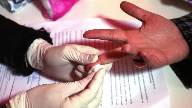 Científicos descubrieron una forma para eliminar células infectadas con VIH