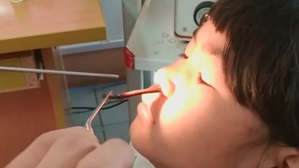 Extraen enorme gusano de la nariz de una niña
