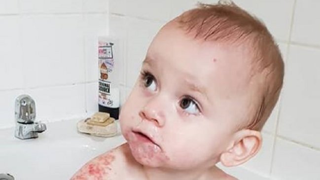 Guagua casi muere después de recibir beso de un familiar