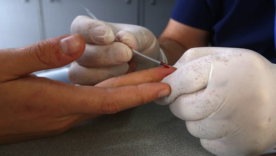 ¿Dónde se toman test rápidos de VIH en la Región Metropolitana durante el verano?