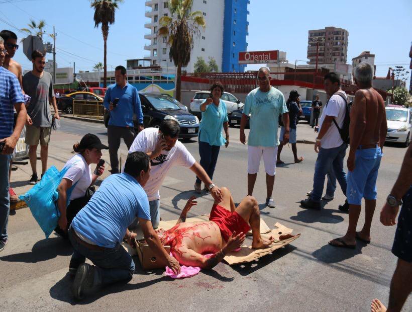 Sujeto fue baleado a quemarropa y a plena luz del día en Iquique